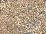 Immunohistochemistry of paraffin-embedded Human tonsil tissue using SSSCA1 Polyclonal Antibody at dilution of 1:50(×200)