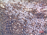 Immunohistochemistry of paraffin-embedded Human tonsil tissue using Cyclin B1 Monoclonal Antibody at dilution of 1:200.