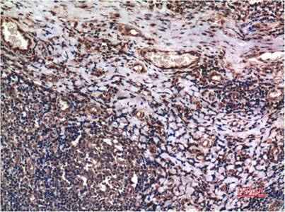 Anti-Human/Mouse/Rat Cyclin B1 Antibody [1A5]