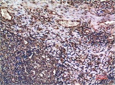Immunohistochemistry of paraffin-embedded Human tonsil tissue using Cyclin B1 Monoclonal Antibody at dilution of 1:200.