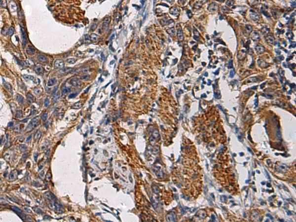 Anti-Human SSH3 Antibody