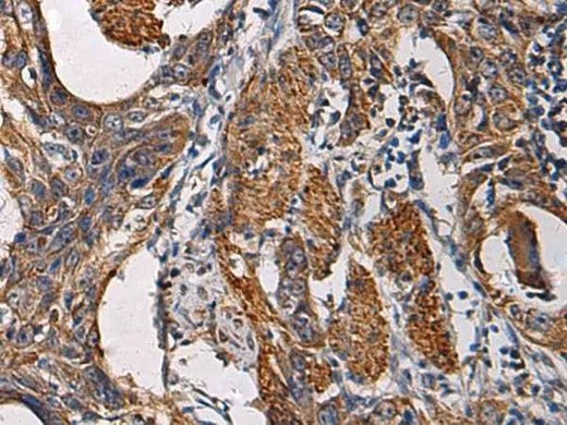Anti-Human SSH3 Antibody