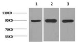 Western Blot analysis of 1) Hela, 2)Mouse brain, 3) Rat brain using HSP90 alpha Monoclonal Antibody at dilution of 1:2000.