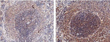 Anti-Rat IL2 Antibody [A1104] - ABMIUM