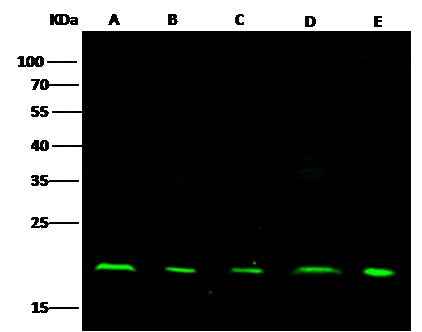 Anti-Human NME1 Antibody [A1176] - ABMIUM
