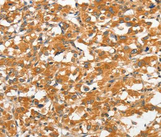 Anti-Human/Mouse ANKMY2 Antibody