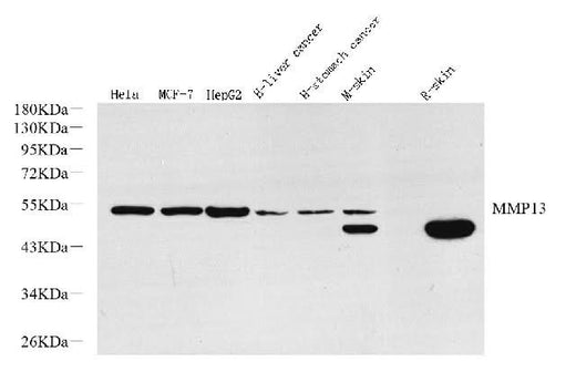 Western Blot analysis of various samples using MMP13 Polyclonal Antibody at dilution of 1:800.