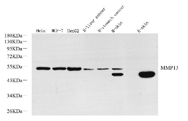 Western Blot analysis of various samples using MMP13 Polyclonal Antibody at dilution of 1:800.