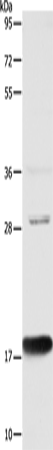 Anti-Human/Mouse AGR2 Antibody - ABMIUM
