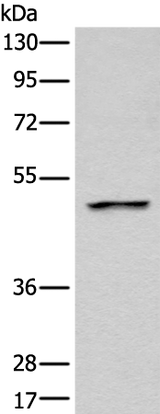 Anti-Human/Mouse/Rat LOX Antibody - ABMIUM