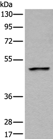 Anti-Human/Mouse/Rat LOX Antibody - ABMIUM