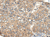 Anti-Human ACER1 Antibody - ABMIUM