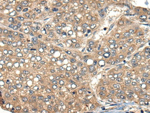 Anti-Human ACER1 Antibody - ABMIUM