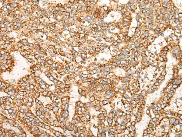Anti-Human/Mouse/Rat NR0B2 Antibody