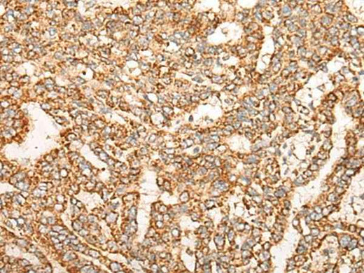 Anti-Human/Mouse/Rat NR0B2 Antibody