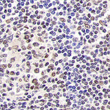 Immunohistochemistry analysis of paraffin-embedded human tonsil using SIRT1 Polyclonal Antibody at dilution of 1:500.