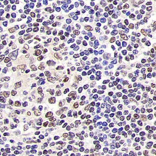 Immunohistochemistry analysis of paraffin-embedded human tonsil using SIRT1 Polyclonal Antibody at dilution of 1:500.