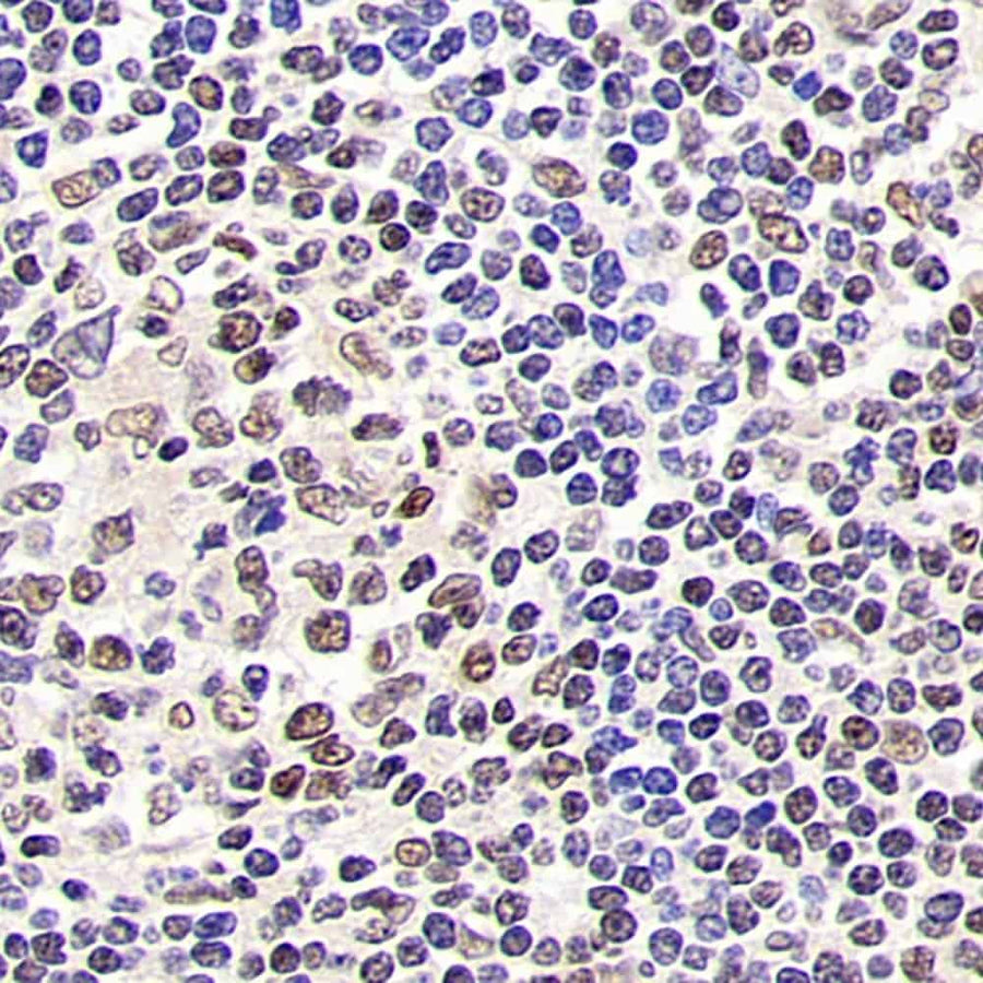 Immunohistochemistry analysis of paraffin-embedded human tonsil using SIRT1 Polyclonal Antibody at dilution of 1:500.