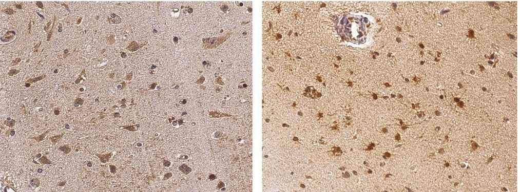 Anti-Human NGF Antibody [B135] - ABMIUM