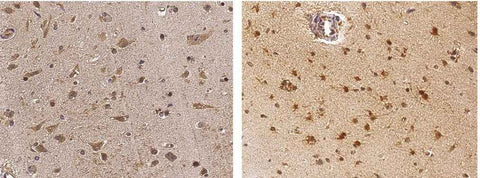 Anti-Human NGF Antibody [B135] - ABMIUM