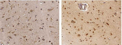 Anti-Human NGF Antibody [B135] - ABMIUM