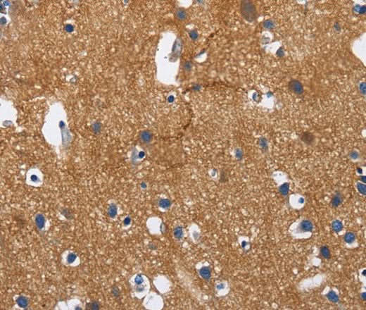 Anti-Human/Mouse/Rat CADM3 Antibody - ABMIUM