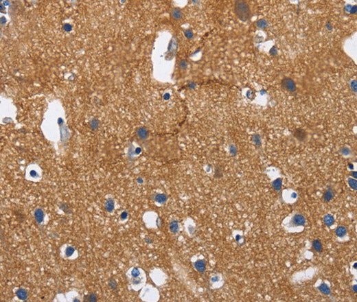 Anti-Human/Mouse/Rat CADM3 Antibody - ABMIUM