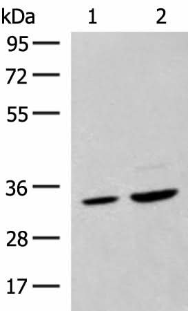 Western blot analysis of Hela cell and Human fetal liver tissue lysates using SCGN Polyclonal Antibody at dilution of 1:600