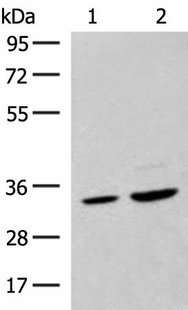 Western blot analysis of Hela cell and Human fetal liver tissue lysates using SCGN Polyclonal Antibody at dilution of 1:600