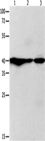 Anti-Human/Mouse/Rat GNAZ Antibody - ABMIUM