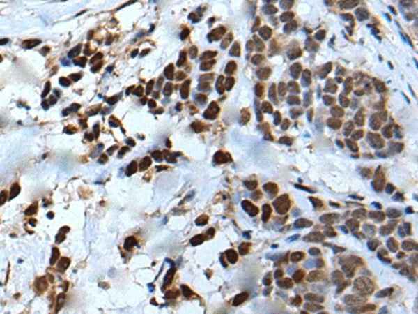 Anti-Human VEZT Antibody