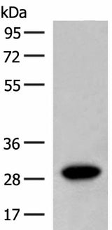 Western blot analysis of Human fetal brain tissue lysate using SCGN Polyclonal Antibody at dilution of 1:600