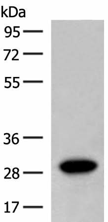 Western blot analysis of Human fetal brain tissue lysate using SCGN Polyclonal Antibody at dilution of 1:600