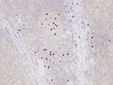 Immunohistochemistry of paraffin-embedded Human tonsil using S100A12 Polycloanl Antibody at dilution of 1:85
