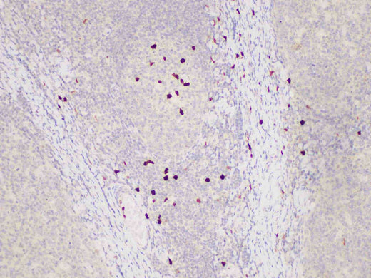 Anti-Human S100A12 Antibody
