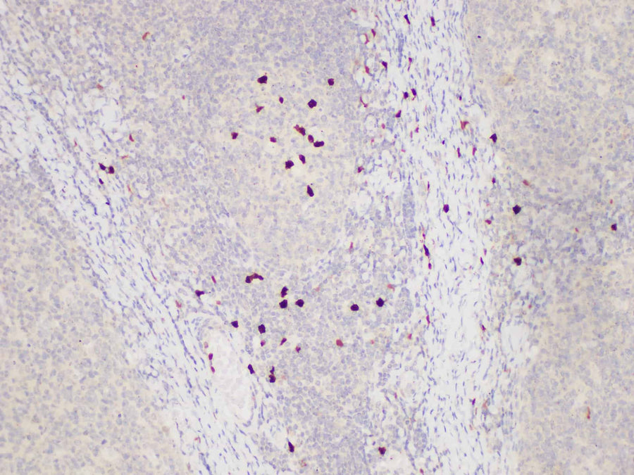 Immunohistochemistry of paraffin-embedded Human tonsil using S100A12 Polycloanl Antibody at dilution of 1:85