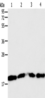 Anti-Human/Mouse DIABLO Antibody - ABMIUM