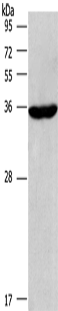 Anti-Human CIAPIN1 Antibody - ABMIUM