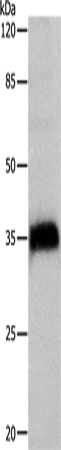 Anti-Human/Mouse/Rat CTSZ Antibody - ABMIUM