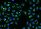 Anti-Human S100B Antibody [A1178] - ABMIUM