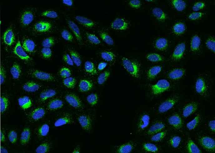 Anti-Human S100B Antibody [A1178] - ABMIUM