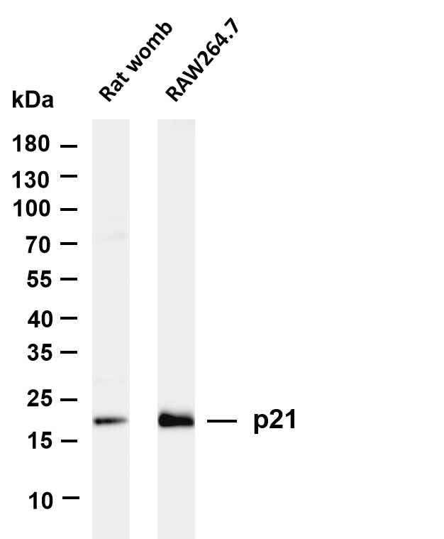 Anti-Mouse/Rat P21 Antibody [B783] - ABMIUM