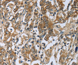 Anti-Human PRL Antibody - ABMIUM