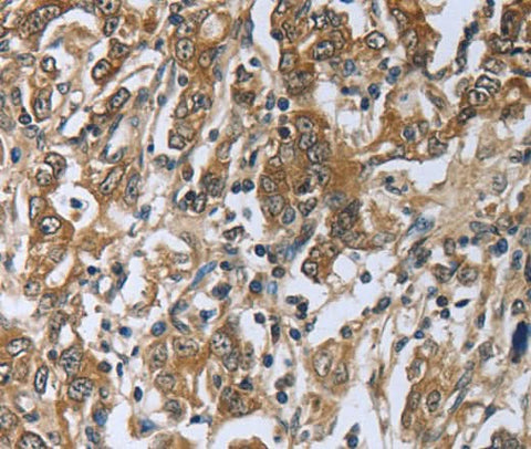 Anti-Human PRL Antibody - ABMIUM