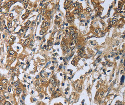 Anti-Human PRL Antibody - ABMIUM