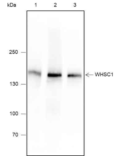 Anti-Human WHSC1 Antibody [A601] - ABMIUM