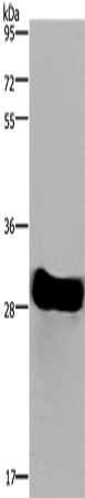 Anti-Human/Mouse/Rat FHL2 Antibody - ABMIUM