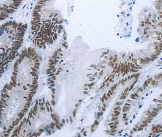 Anti-Human/Mouse/Rat RBMS1 Antibody