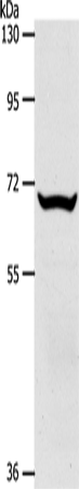Anti-Human/Mouse/Rat SLC33A1 Antibody - ABMIUM