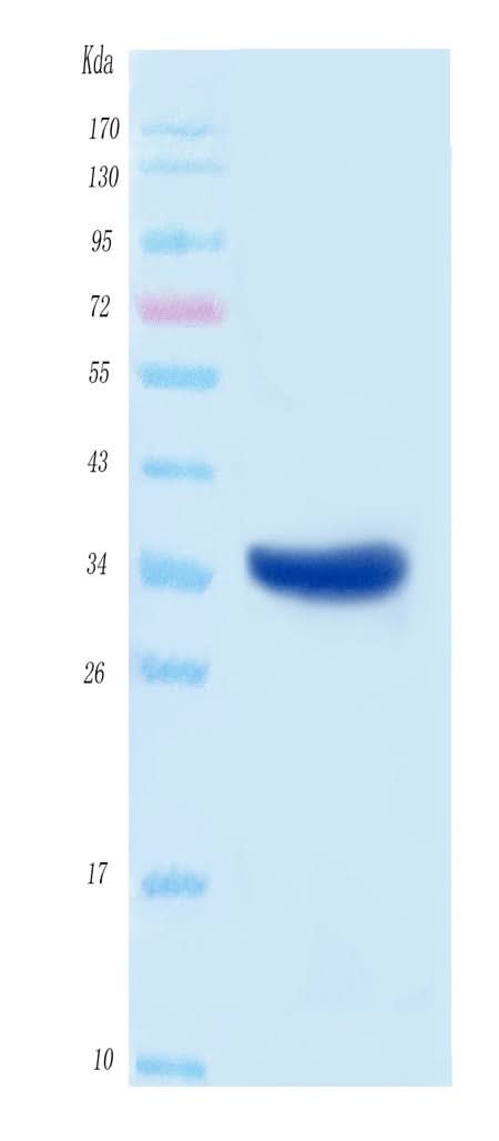 SARS-CoV-2 (COVID-19) NSP5A Protein, His Tag Boster Bio
